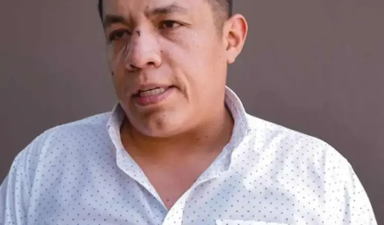 Agreden al periodista Jorge Heras en Mexicali; CEDHBC y autoridades exigen protección e investigación